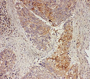 GRB7 Antibody (aa124-141)