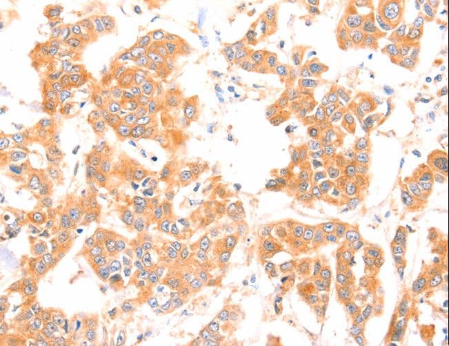 PRDX2 / Peroxiredoxin 2 Antibody