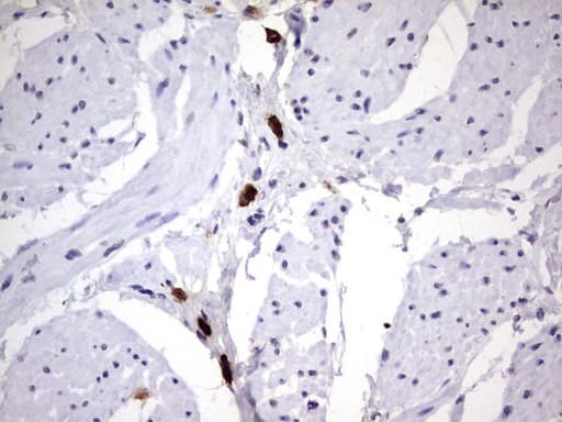 Monoclonal Mouse anti-Human MAP1LC3A / LC3A Antibody (clone OTI10H6, IHC, WB)