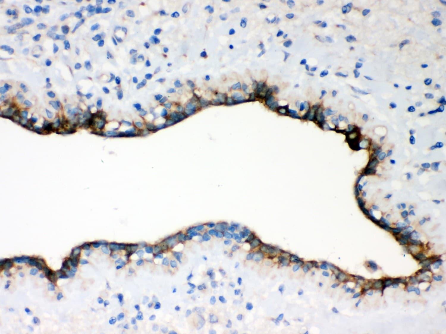 OCLN / Occludin Antibody (aa373-522)