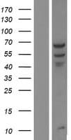 Human PPP2R1B Protein (Over-Expression Lysate Myc-DDK (Flag))