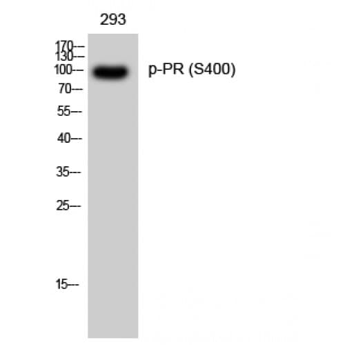 Polyclonal Rabbit anti-Human PR / Progesterone Receptor Antibody (340-420 aa, IF, WB)