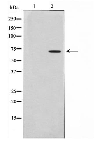 IVL / Involucrin Antibody