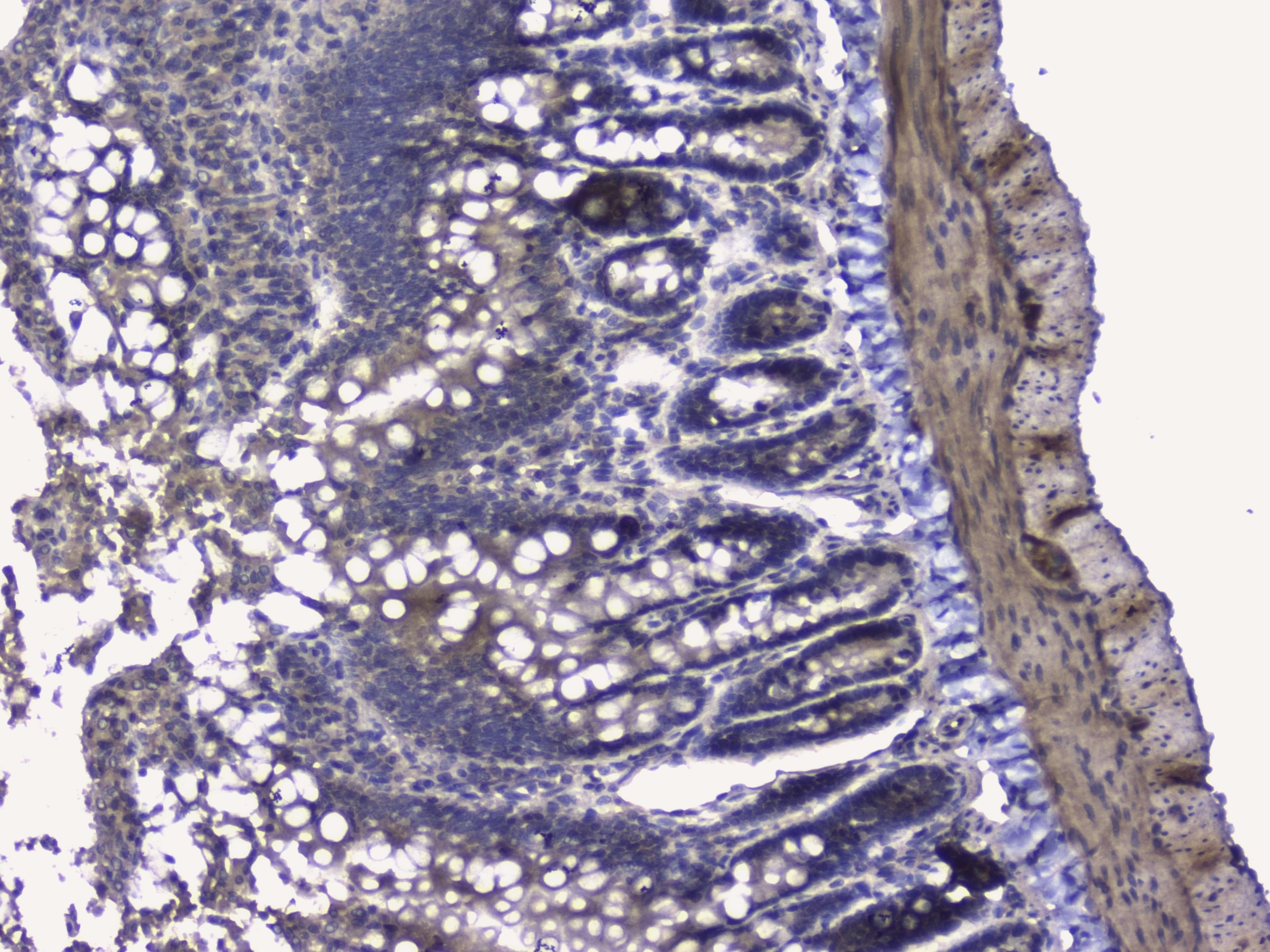 Polyclonal Rabbit anti-Human RIP1 / RALBP1 Antibody (IHC, WB)