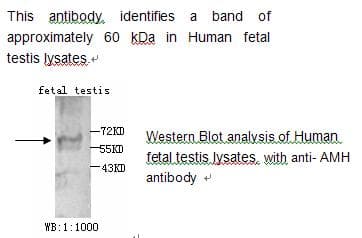 AMH / Anti-Mullerian Hormone Antibody