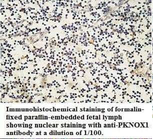 PKNOX1 / PREP1 Antibody (aa31-286)