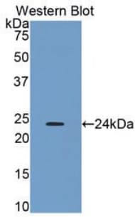 ORM2 / Orosomucoid 2 Antibody (aa19-201, Biotin)