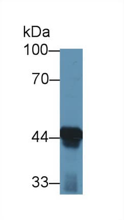 ACAA1 Antibody