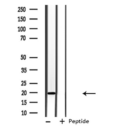 Polyclonal Rabbit anti-Human ARF6 Antibody (IF, WB)