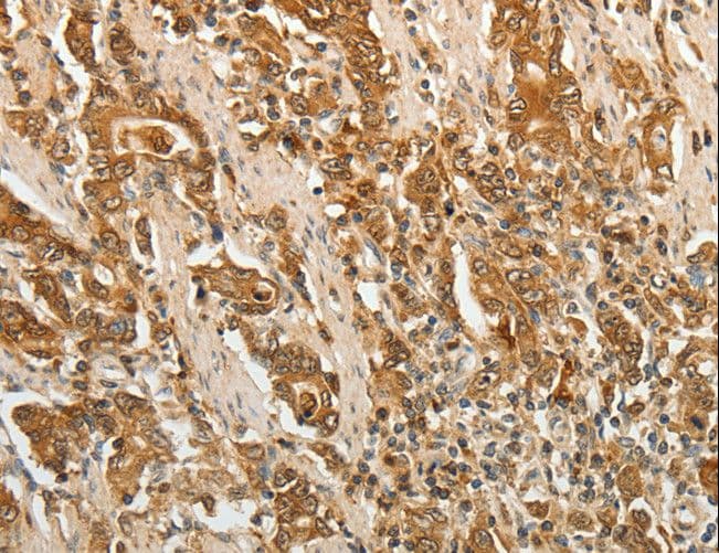 Polyclonal Rabbit anti-Human F3 / CD142 / Tissue factor Antibody (IHC, WB)