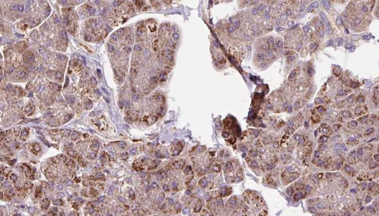PDHB Antibody