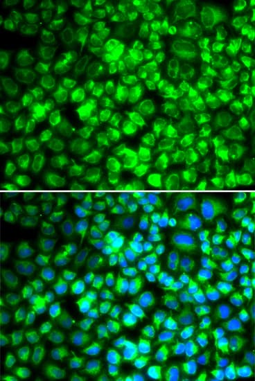 IHC-plus™ Polyclonal Rabbit anti-Human ATP5A1 / ATP Synthase Alpha Antibody (IHC, IF, WB)