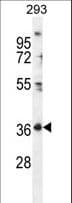 FR4 / Folate Receptor 4 Antibody (aa17-46)