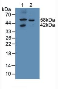 GALNS / Chondroitinase Antibody (aa172-381, PE)