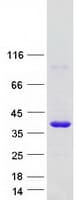 Human GDPD1 Protein (Recombinant Myc-DDK (Flag))