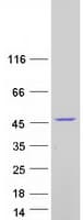 Human HSD3B2 Protein (Recombinant Myc-DDK (Flag))