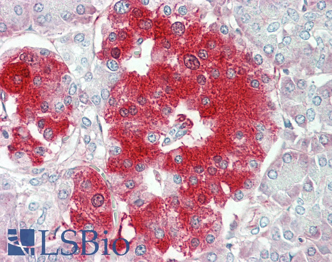 IHC-plus™ Polyclonal Rabbit anti-Human TNFRSF21 / DR6 Antibody (aa356-385, IHC, WB)