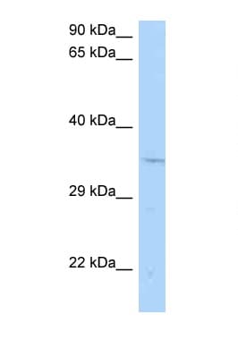 Polyclonal Rabbit anti-Rat CNTD1 Antibody (aa201-250, WB)