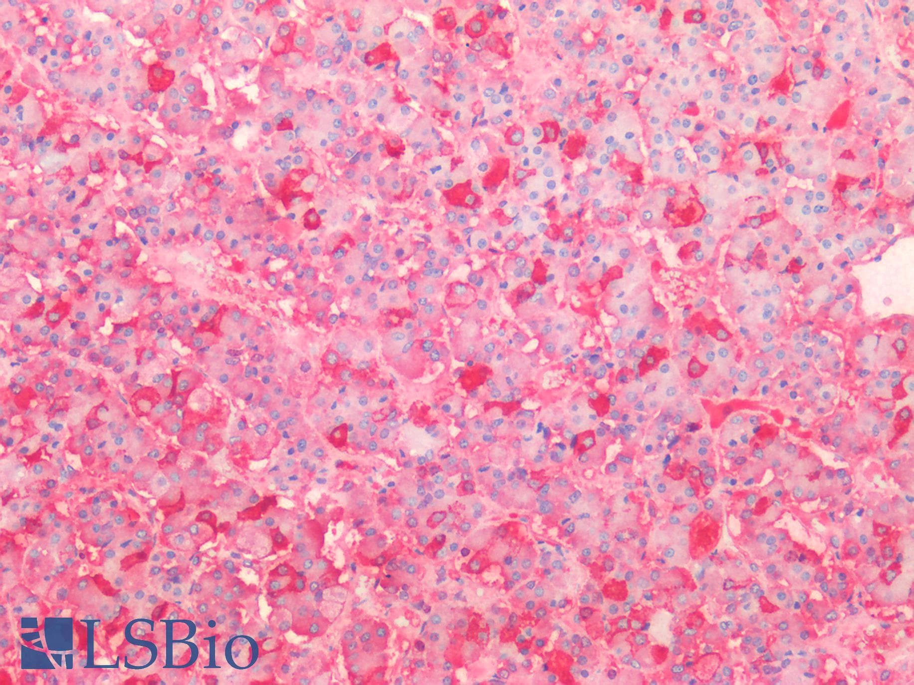 PathPlus™ FSH Antibody (Concentrated)