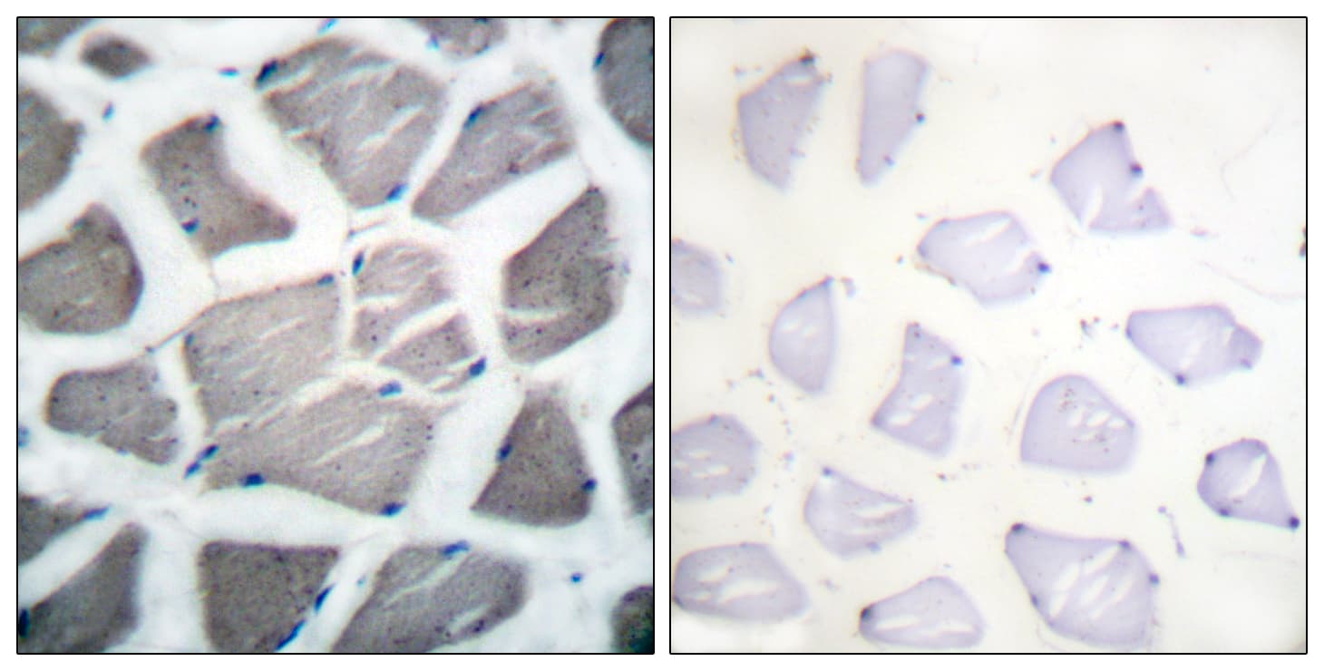 BAK1 / BAK Antibody (aa1-50)