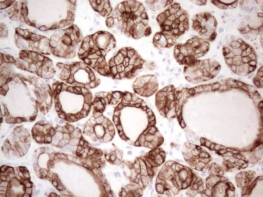 KRT16 / CK16 / Cytokeratin 16 Antibody (clone OTI2H8)
