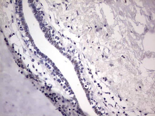 Monoclonal Mouse anti-Human ER Alpha / Estrogen Receptor Antibody (clone OTI8E9, aa1-310, IHC, WB)