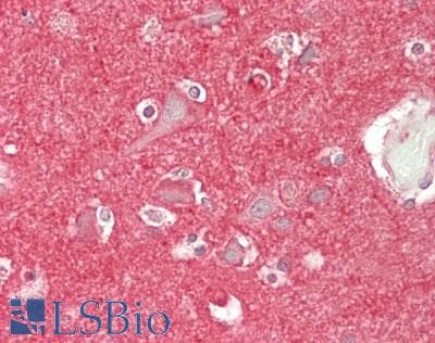 ANXA6/Annexin A6/Annexin VI Antibody (Biotin)