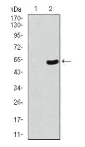 Monoclonal Mouse anti-Human TP53BP1 / 53BP1 Antibody (clone 6B3E10, aa500-800, IHC, WB)
