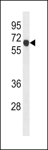 CCNB1 / Cyclin B1 Antibody (aa299-326)