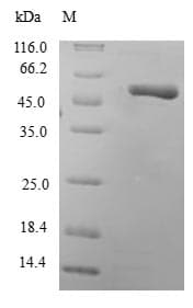 Human RAB10 Protein (Recombinant 6His, N-terminus)