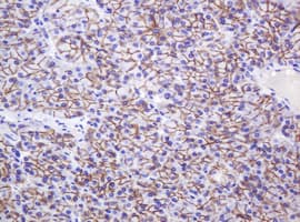 CTNND1 / p120 Catenin Antibody (clone OTI2E8)