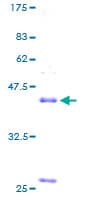 Human NPPB / BNP Protein (Recombinant GST)