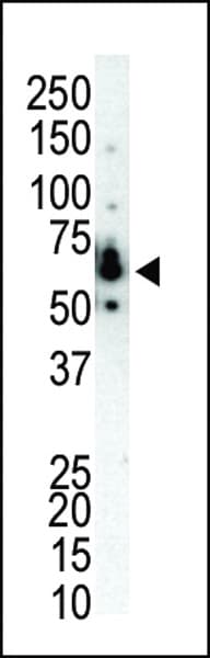 Polyclonal Rabbit anti-Human PRKCH / PKC-Eta Antibody (aa210-239, IHC, WB)