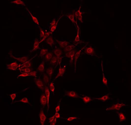 CTNNA1 / Catenin Alpha-1 Antibody