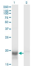 SKP1 Antibody (clone 1H8)