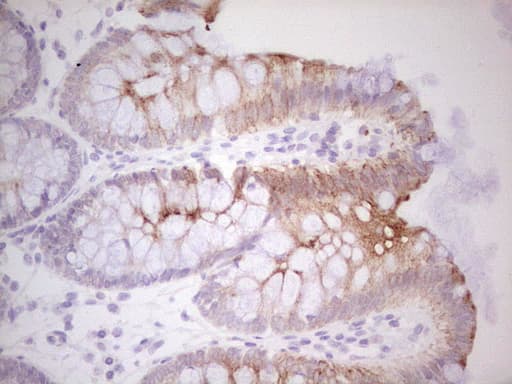 ABCB1 / MDR1 / P Glycoprotein Antibody (aa995-1280, clone OTI10H3)