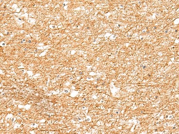 Ls31689 Antibody