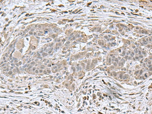 NEUROG3 / NGN3 / Neurogenin 3 Antibody