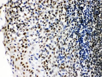 XRCC6 / Ku70 Antibody