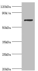 Polyclonal Rabbit anti-Human SLC25A13 / CITRIN Antibody (aa1-300, WB)
