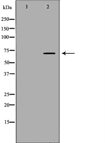 BTRCP / BETA-TRCP Antibody