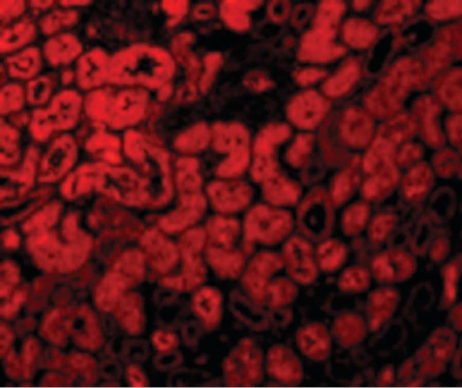 ACE2 / ACE-2 Antibody