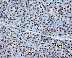 XRCC1 Antibody (clone OTI2F8)