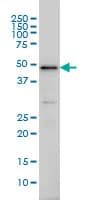 IRF2 Antibody (clone 3B5)