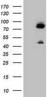 F13A1 / Factor XIIIa Antibody (clone OTI4D2)