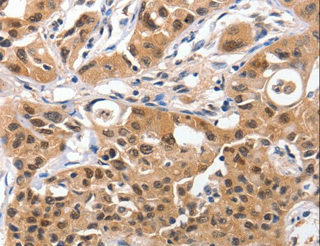 YWHAE / 14-3-3 Epsilon Antibody