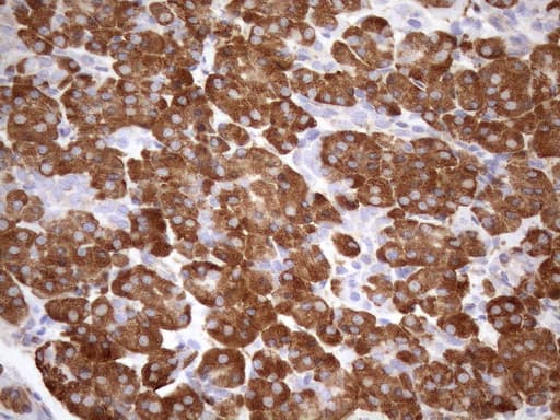 Monoclonal Mouse anti-Human NT5E / eNT / CD73 Antibody (clone OTI1G2, aa119-232, IHC, WB)