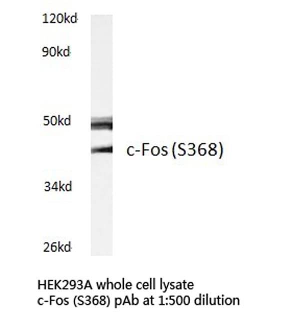 Polyclonal Rabbit anti-Human FOS / c-FOS Antibody (Ser368, IHC, WB)