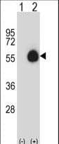 Polyclonal Rabbit anti-Human CD33 Antibody (aa88-117, WB)