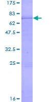 Human DDB2 Protein (Recombinant GST)